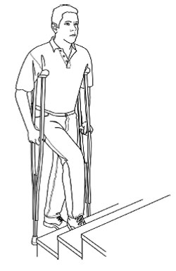 طریقه و اصول استفاده از عصا بعد از عمل جراحی با تصویر به همراه آموزش استفاده درست هنگام راه رفتن، نشستن، از پله بالا و پایین رفتن و سوار و پیاده ماشین توسط دکتر فوق تخصص زانو asazirbaghal12