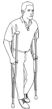 asazirbaghal8 طریقه و اصول استفاده از عصا بعد از عمل جراحی با تصویر به همراه آموزش استفاده درست هنگام راه رفتن، نشستن، از پله بالا و پایین رفتن و سوار و پیاده ماشین توسط دکتر فوق تخصص زانو