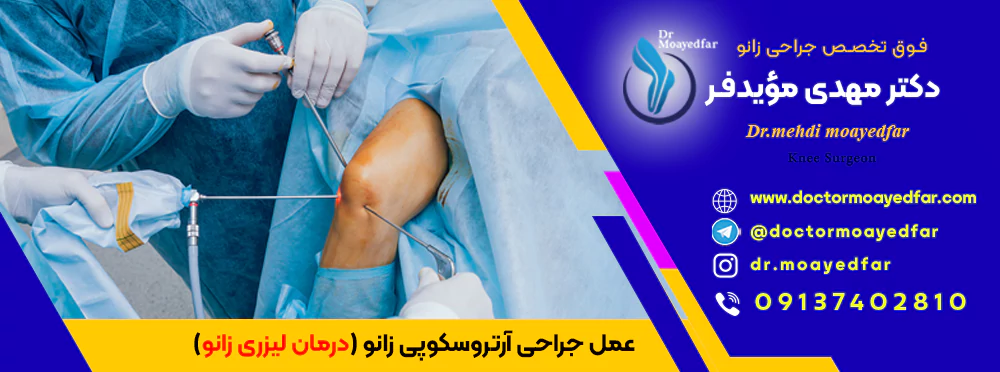 best doctor Knee arthroscopy iran بهترین دکتر جراح عمل جراحی آرتروسکوپی زانو برای درمان لیزری زانو اصفهان)